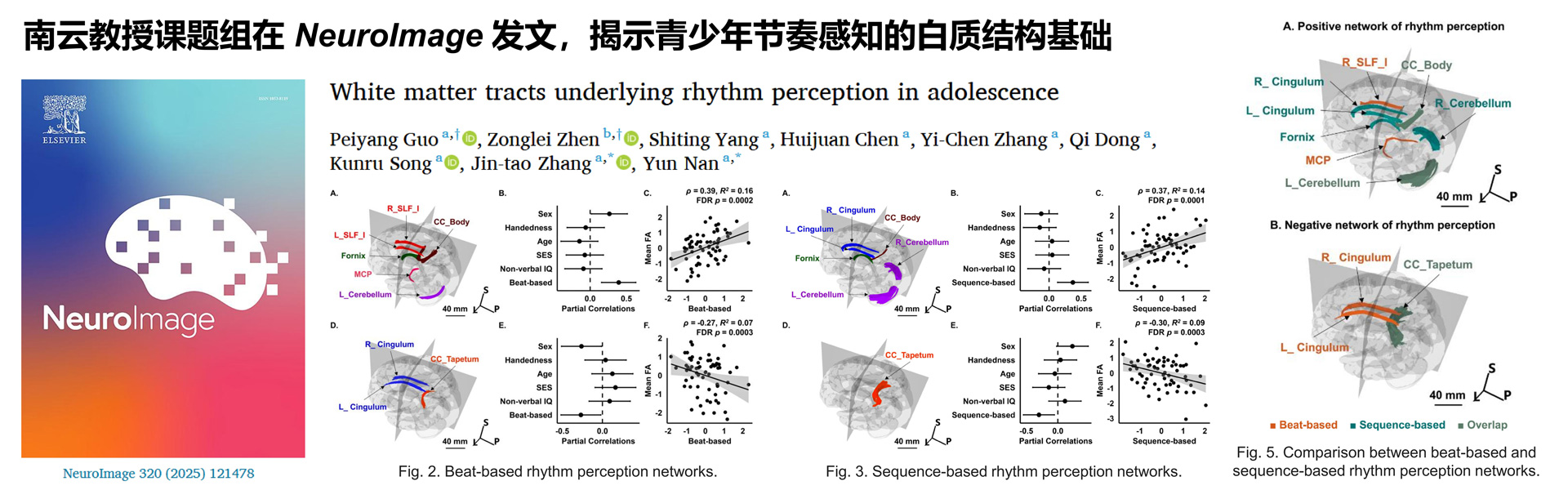南云教授课题组与合作者在NeuroImage发文揭示青少年节奏感知的白质结构基础