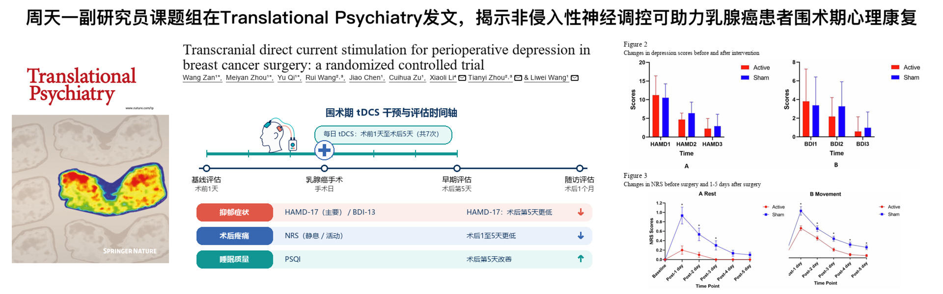 周天一副教授与合作团队在Translational Psychiatry发文揭示非侵入性神经调控助力乳腺癌患者围术期心理康复